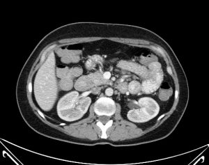 ct_dual_energy_addition